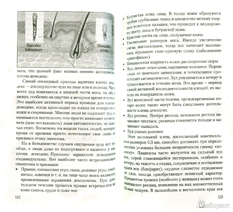 Клещи домашней пыли - белое пятно в медицине - Свищева Тамара Яковлевна ...