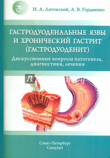 Гастродуоденальные язвы и хронический гастрит
