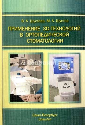 Применение 3D-технологий в ортопед. стоматологии