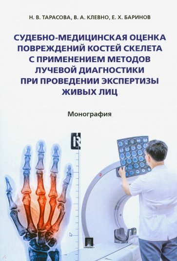 Судебно-медицинская оценка повреждений костей скелета с применением методов лучевой диагностики при