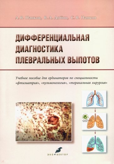 Дифференциальная диагностика плевральных выпотов