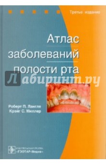 Атлас заболеваний полости рта Атлас заболеваний полости рта