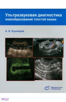 Ультразвуковая диагностика новообразований толстой кишки - Александр Кушнеров
