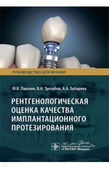 Рентгенологическая оценка качества имплантационного протезирования Руководство 892₽