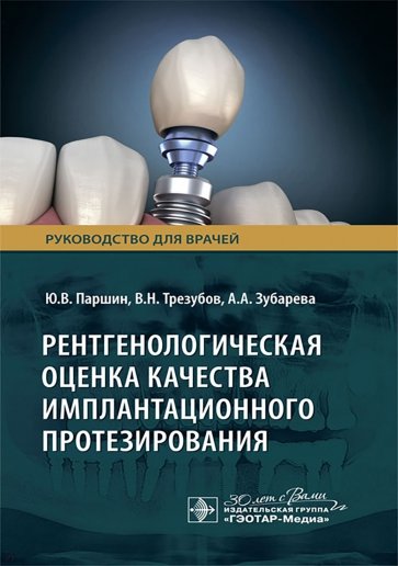 Рентгенологическая оценка качества имплантационного протезирования. Руководство