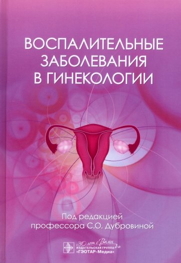 Воспалительные заболевания в гинекологии
