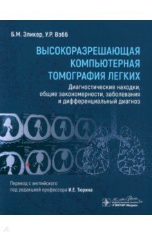 Высокоразрешающая компьютерная томография легких Диагностические находки общие закономерности 7213₽