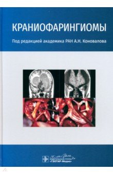 Обложка книги Краниофарингиомы, Коновалов Александр Николаевич