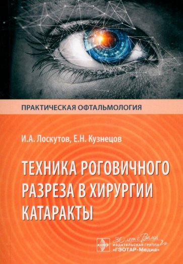 Техника роговичного разреза в хирургии катаракты