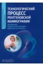 Технологический процесс рентгеновской маммографии - Каприн Андрей Дмитриевич, Рожкова Надежда Ивановна, Буданова Мария Владиславовна