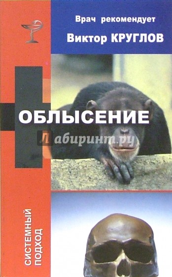 Облысение