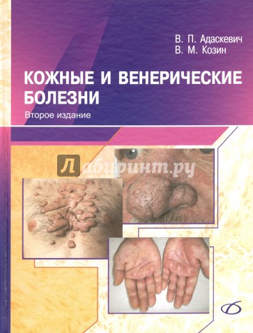 Кожные и венерические болезни