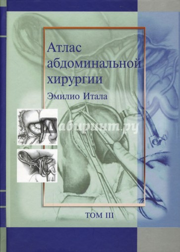 Атлас абдоминальной хирургии. Том3. Хирургия тонкой и толстой кишки, прямой кишки и анальной области