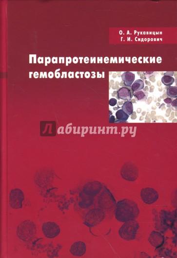 Парапротеинемические гемобластозы