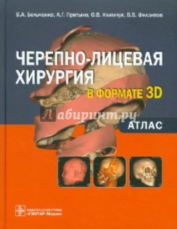 Черепно-лицевая хирургия  в формате 3D: атлас