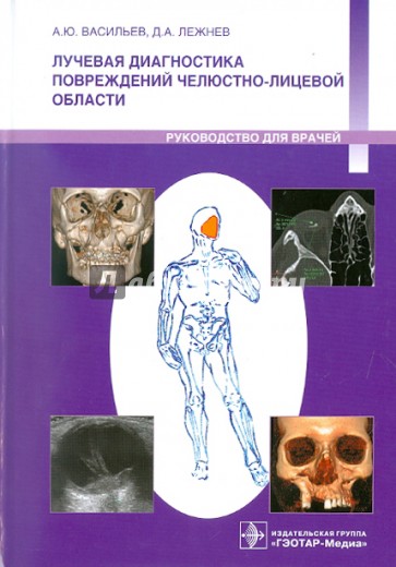 Лучевая диагностика повреждений челюстно-лицевой области