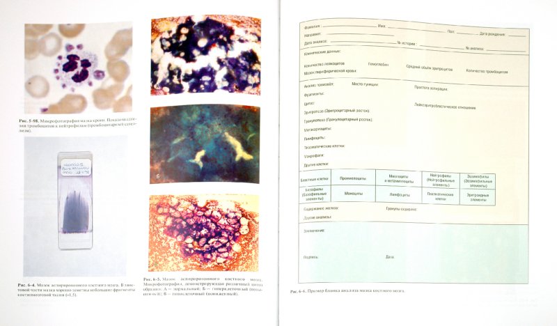 Иллюстрация 1 из 20 для Практическая и лабораторная гематология - Льюис, Бэйн, Бэйтс | Лабиринт - книги. Источник: Лабиринт