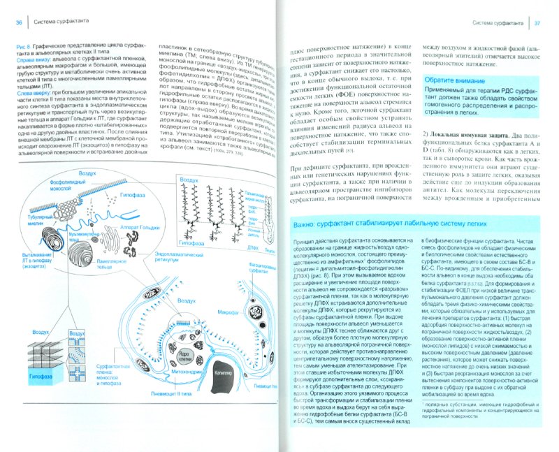 Иллюстрация 1 из 3 для Сурфактант в неонатологии. Профилактика и лечение респираторного дистресс-синдрома новорожденных - Роланд Вауэр | Лабиринт - книги. Источник: Лабиринт