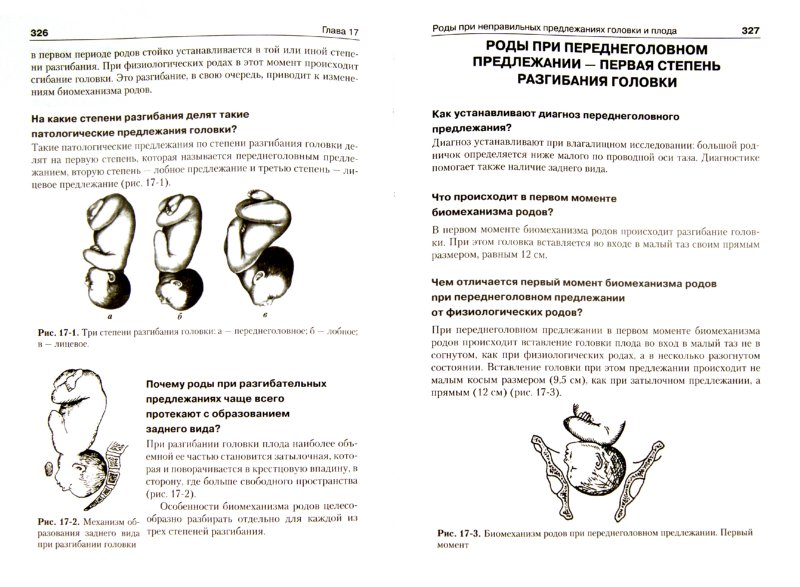 Иллюстрация 1 из 7 для Руководство к практическим занятиям по акушерству - Радзинский, Костин, Гагаев | Лабиринт - книги. Источник: Лабиринт