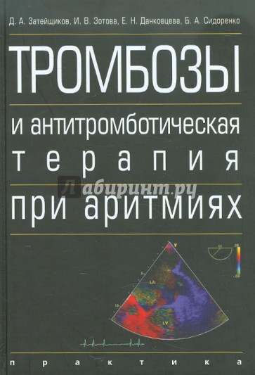 Тромбозы и антитромботическая терапия при аритмиях