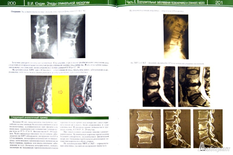 Иллюстрация 1 из 2 для Этюды спинальной хирургии - Виктор Юндин | Лабиринт - книги. Источник: Лабиринт
