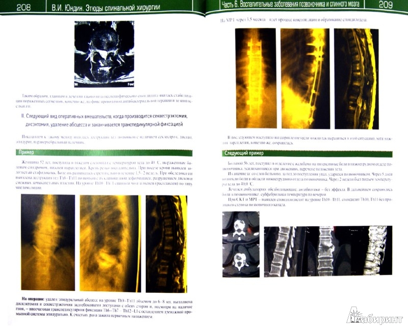 Иллюстрация 2 из 2 для Этюды спинальной хирургии - Виктор Юндин | Лабиринт - книги. Источник: Лабиринт