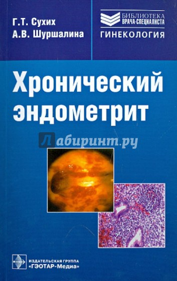 Хронический эндометрит: руководство