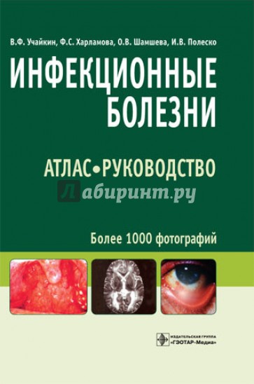 Инфекционные болезни. Атлас: руководство