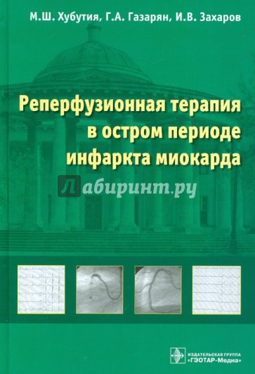 Реперфузионная терапия в остром периоде инфаркта миокарда