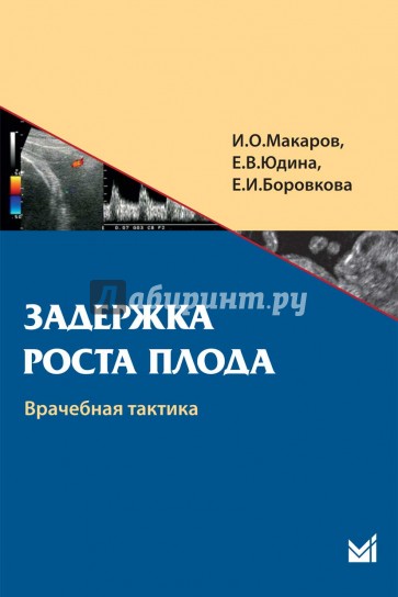 Задержка роста плода: врачебная тактика. Учебное пособие