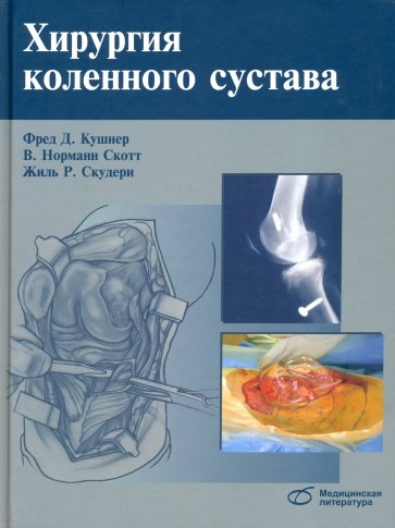 Хирургия коленного сустава