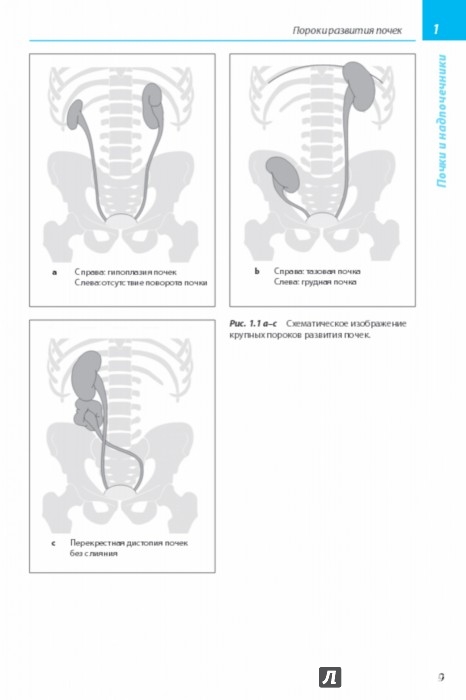 Иллюстрация 2 из 23 для Лучевая диагностика. Болезни мочеполовой системы - Хамм, Асбах, Бейерсдорф, Хайн, Лемке | Лабиринт - книги. Источник: Лабиринт