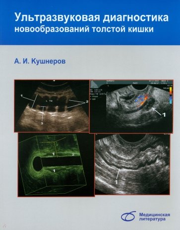 Ультразвуковая диагностика новообразований толстой кишки