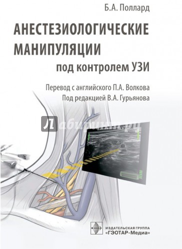 Анестезиологические манипуляции под контролем УЗИ