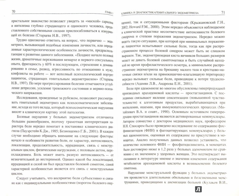 Эндометриоз современные подходы к лечению