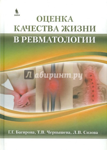 Оценка качества жизни в ревматологии