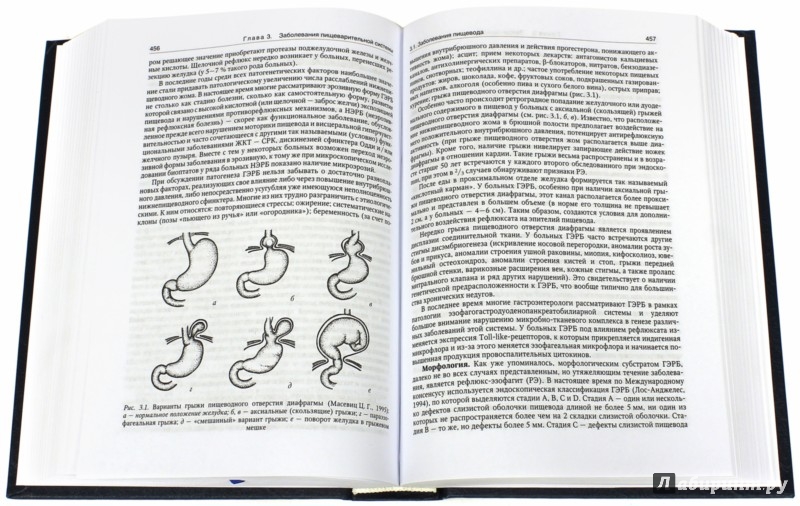 Внутренние болезни учебник рябов