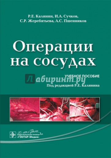 Операции на сосудах. Учебное пособие