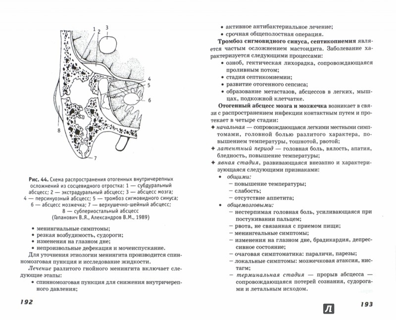 Иллюстрация 1 из 13 для Болезни уха, горла, носа. Учебное пособие - Светлана Ананьева | Лабиринт - книги. Источник: Лабиринт