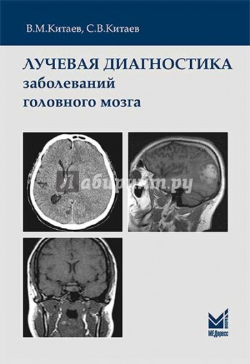 Лучевая диагностика заболеваний головного мозга