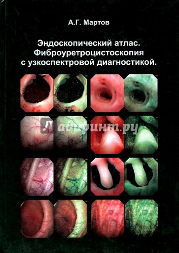 Эндоскопический атлас. Фиброуретроцистоскопия с узкоспектровой диагностикой