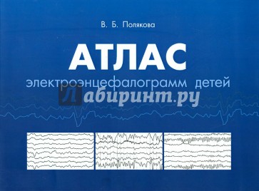 Атлас электороэнцифалограмм детей