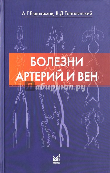 Болезни артерий и вен