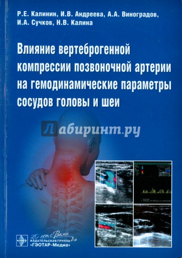 Влияние вертеброгенной компрессии позвоночной артерии на гемодинамические параметры сосудов головы