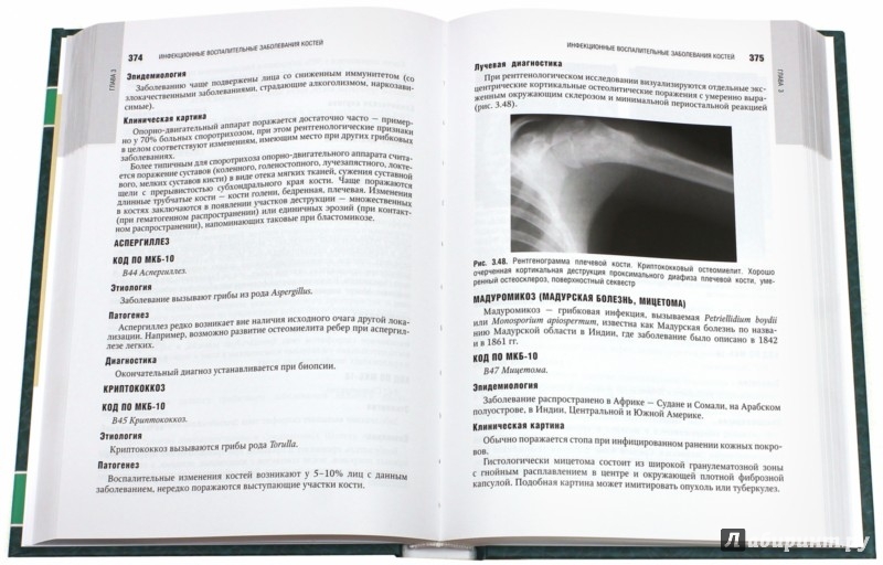 Иллюстрация 1 из 11 для Лучевая диагностика заболеваний костей и суставов. Национальное руководство | Лабиринт - книги. Источник: Лабиринт