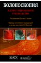 Колоноскопия. Иллюстрированное руководство браун дэнис вичелло ароматерапия иллюстрированное руководство