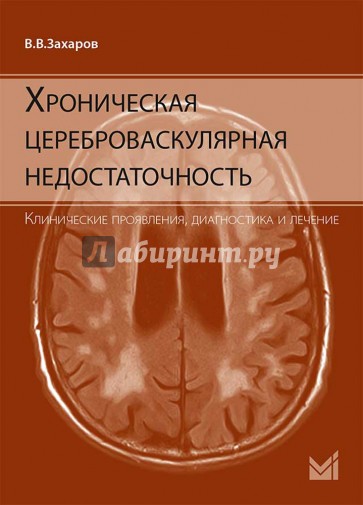 Хроническая цереброваскулярная недостаточность