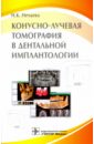 Нечаева Наталья Константиновна Конусно-лучевая томография в дентальной имплантологии основы дентальной имплантологии иванов с мураев а