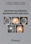 Хирургия массивного ишемического инсульта