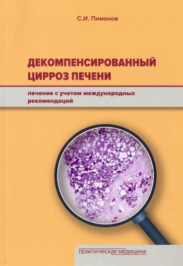 Декомпенсирован.цирроз печени.Леч. учетом межд.рек